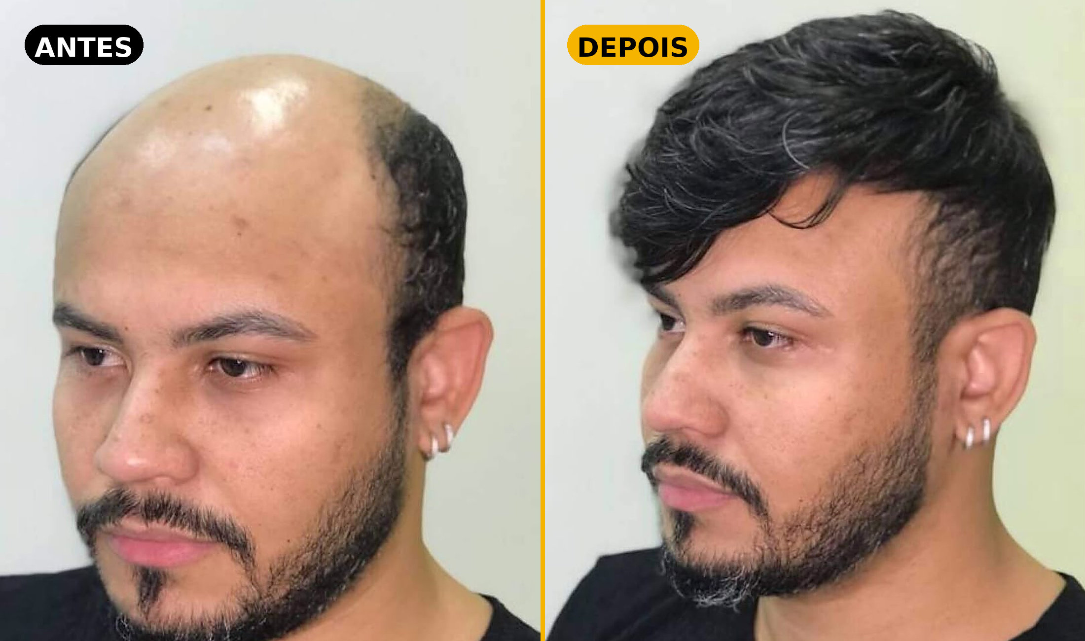 Antes e depois — Cliente