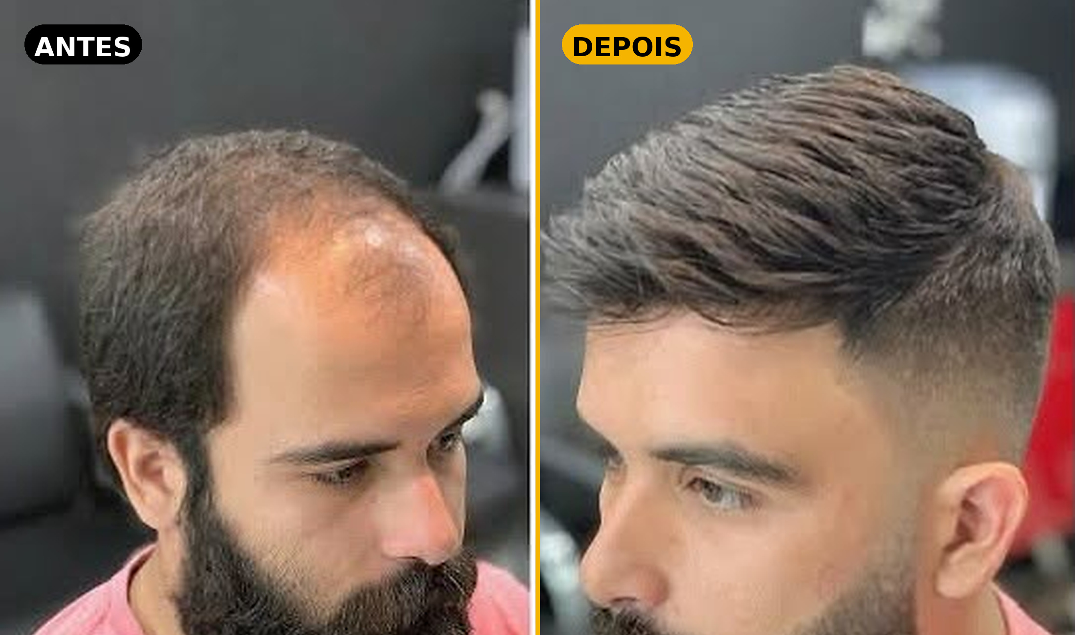 Antes e depois — Cliente