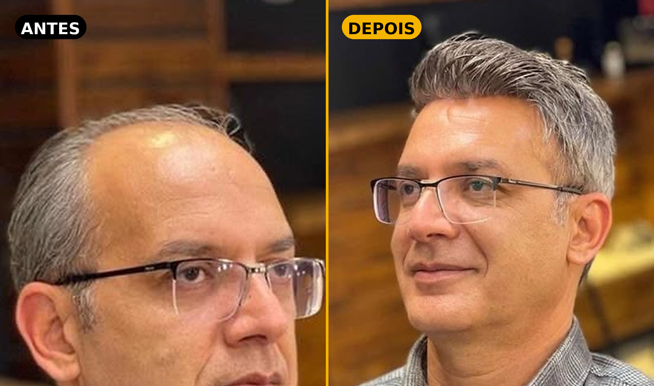 Antes e depois — Cliente